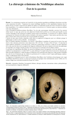 08-2022, tome 119, 2, p.295-324  Escola M (2022)  La chirurgie crnienne du Nolithique alsacien : tat de la question
